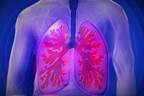 Malattie polmonari professionali