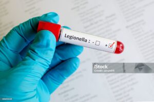 rischio legionella condizionatori
